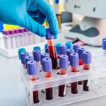 Gloved hand handling blood samples in a laboratory.