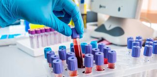 Gloved hand handling blood samples in a laboratory.