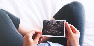 pregnant woman holding a picture of sonagram showing a child