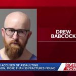 Dad Causes 30 Fractures in Baby’s Body – Horrific Abuse! Dad Causes 30 Fractures in Baby’s Body - Horrific Abuse