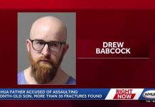 Dad Causes 30 Fractures in Baby’s Body - Horrific Abuse