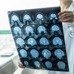 Can a Simple Gas Clean the Brain? Doctor holding brain MRI scan film