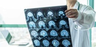 Doctor holding brain MRI scan film