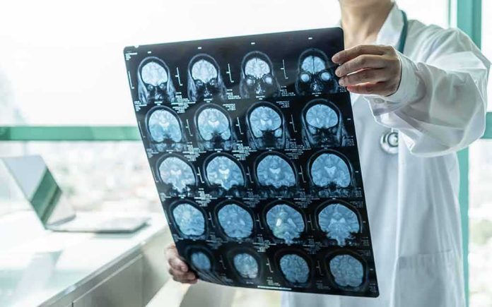 Doctor holding brain MRI scan film