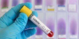 Gloved hand holding a blood sample tube labeled for listeria test